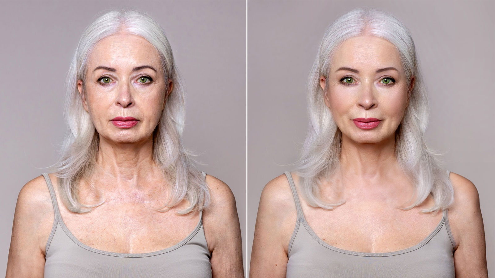 understanding different types of face lifts which is right for you