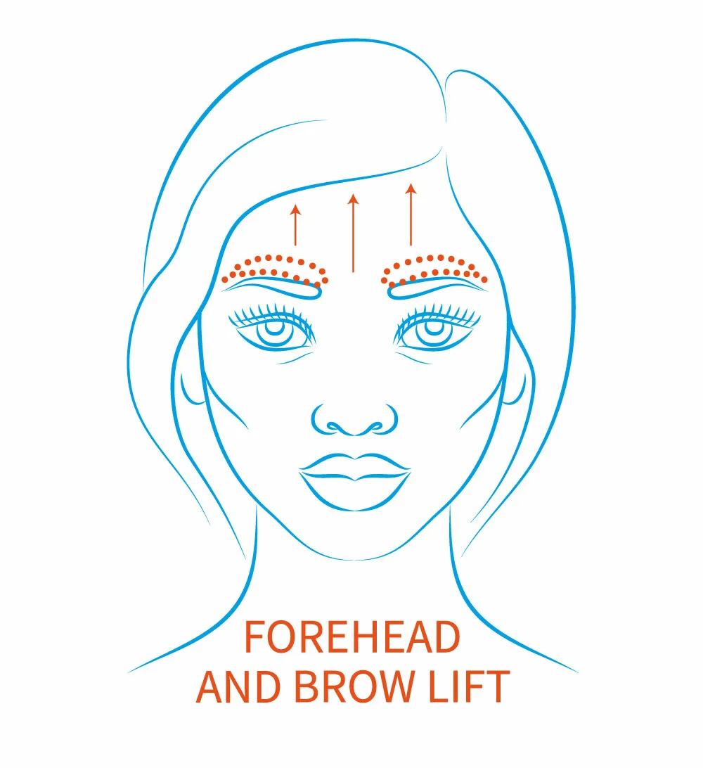 Forehead Lift Surgery