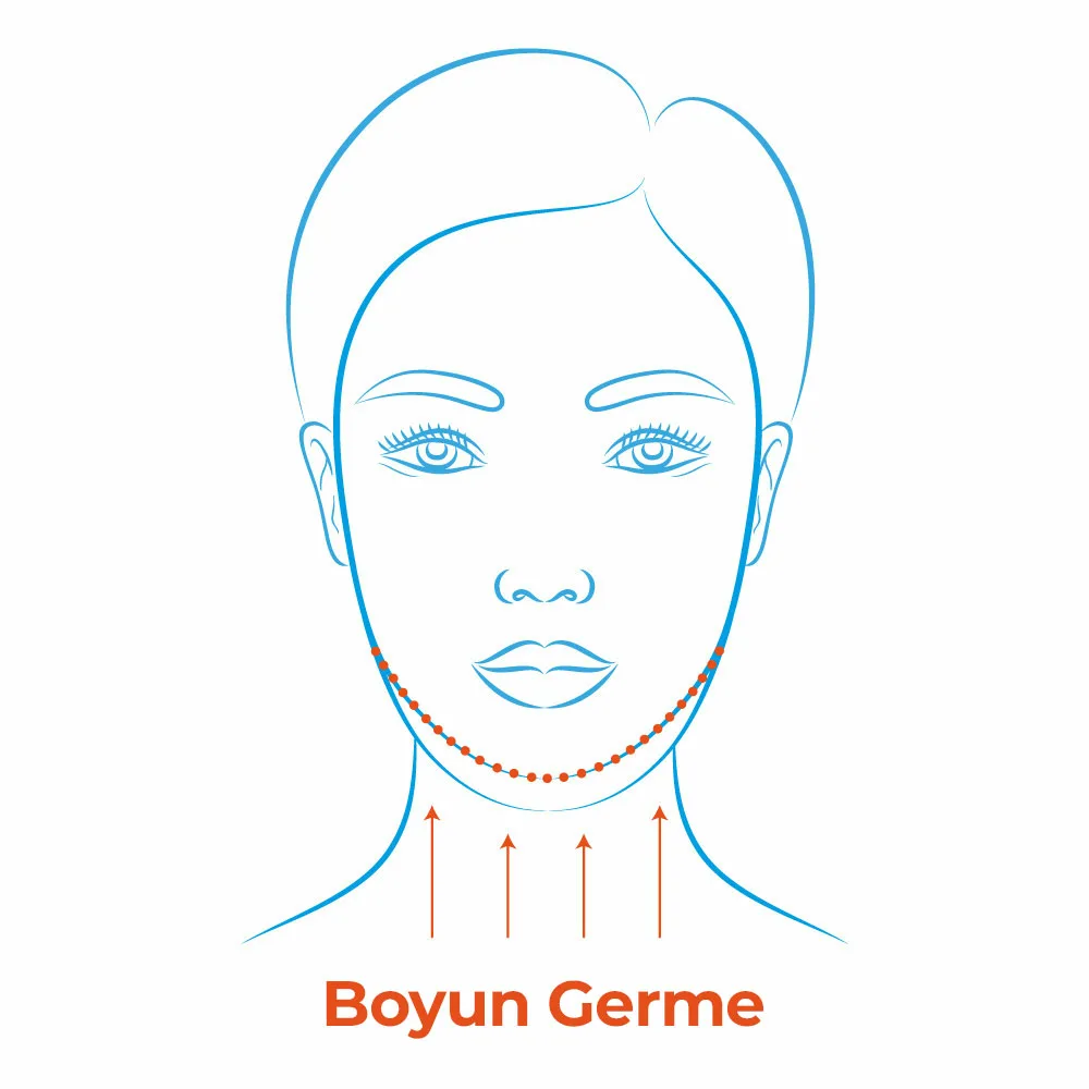 Boyun Germe 1 Boyun Germe