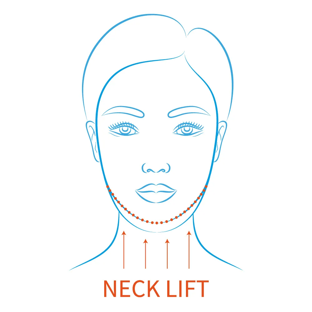 Neck lift surgery