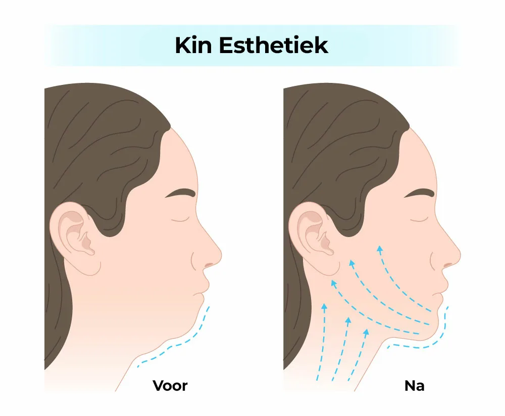 Kin Esthetiek Kinpunt Esthetiek