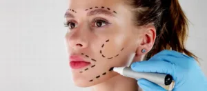 Facelift and Brow Lift Facelift and Brow Lift.