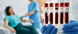 Ameliyat Oncesi Yapilan Testler Nelerdir Welche Tests werden vor der Operation durchgeführt?