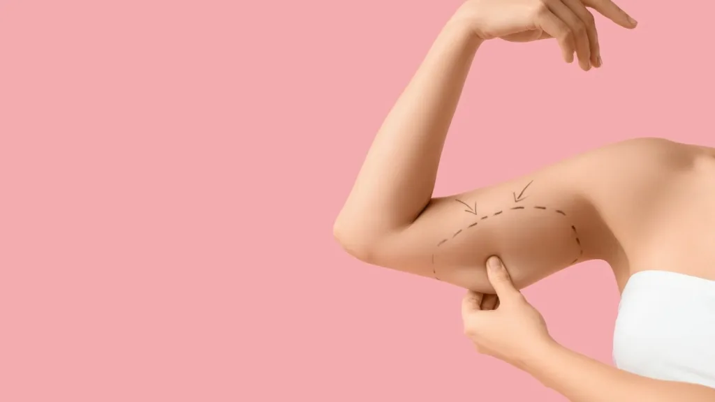 Recovery After Arm Lift Surgery: What Should Be Considered? 1 Kol Germe Estetigi Sonrasi Iyilesme Nelere Dikkat Edilmeli Recovery After Arm Lift Surgery: What Should Be Considered?
