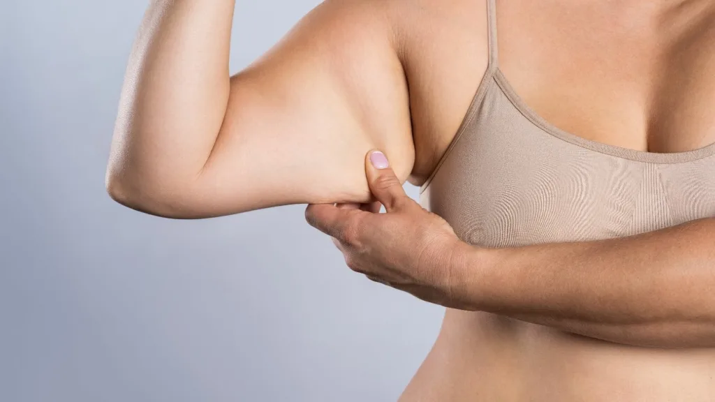 What Is Arm Sagging and How Is It Treated? 1 Kol Sarkikliklari Nedir Tedavisi Nasil Yapilir What Is Arm Sagging and How Is It Treated?