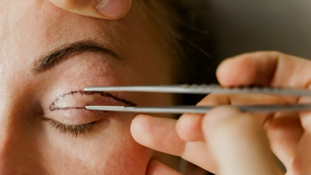 Türkiye Neden En İyi Göz Kapağı Ameliyatı Yapan Doktorlara Sahip? 1 Turkiye Neden En Iyi Goz Kapagi Ameliyati Yapan Doktorlara Sahip Türkiye Neden En İyi Göz Kapağı Ameliyatı Yapan Doktorlara Sahip?