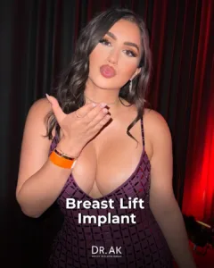 Breast Lift with 425 cc Moderate-Profile Implants Before and After 4 Breast Lift with 425 cc Moderate Profile Implants Before and After 1 Breast Lift with 425 cc Moderate-Profile Implants Before and After
