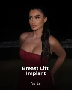 Breast Lift with 425 cc Moderate-Profile Implants Before and After 3 Breast Lift with 425 cc Moderate Profile Implants Before and After 2 Breast Lift with 425 cc Moderate-Profile Implants Before and After