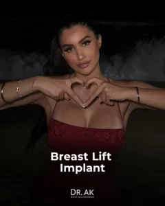 Breast Lift with 425 cc Moderate-Profile Implants Before and After 2 Breast Lift with 425 cc Moderate Profile Implants Before and After 3 Breast Lift with 425 cc Moderate-Profile Implants Before and After
