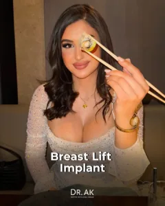 Breast Lift with 425 cc Moderate-Profile Implants Before and After 1 Breast Lift with 425 cc Moderate Profile Implants Before and After 4 Breast Lift with 425 cc Moderate-Profile Implants Before and After