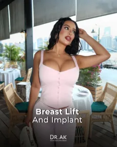 Breast Lift with 475 cc Moderate-Profile Implants Before and After 3 Breast Lift with 475 cc Moderate Profile Implants Before and After 2 Breast Lift with 475 cc Moderate-Profile Implants Before and After