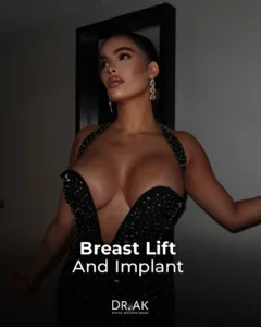 Breast Lift with 475 cc Moderate-Profile Implants Before and After 2 Breast Lift with 475 cc Moderate Profile Implants Before and After 3 Breast Lift with 475 cc Moderate-Profile Implants Before and After